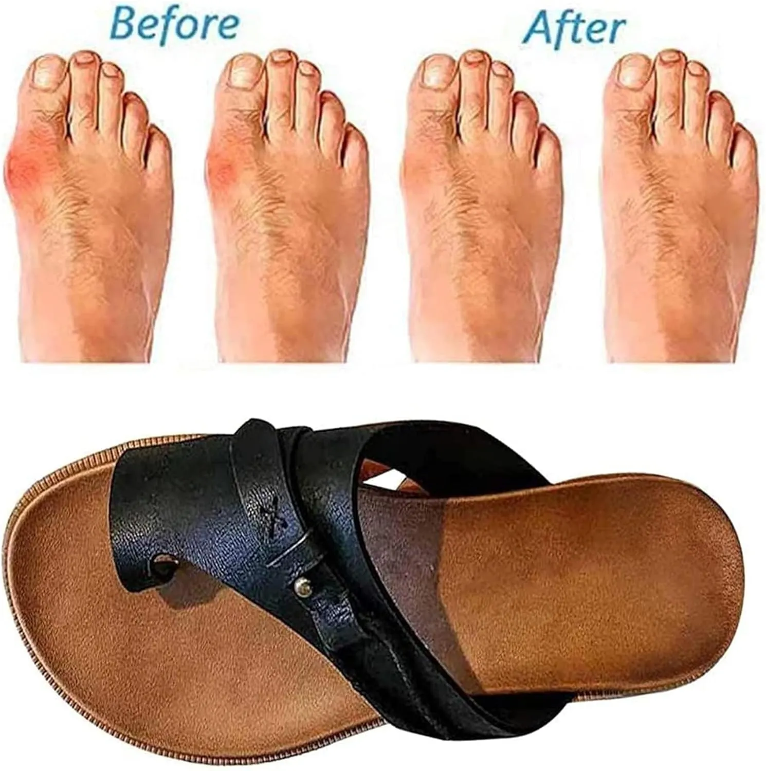 BBPM Women Orthopedic Sandals Bunion Correction Sandals PU Leather Retro Flat Heel Flip Flops Clip Toe Flat Beach Walking Shoes Open Toe Breathable Casual Travel Shoes,Silver,EU38/US7